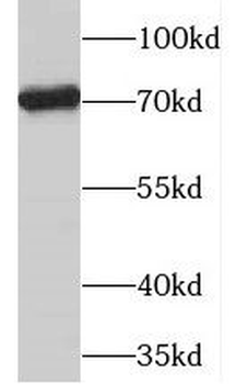 PGM2L1 Antibody