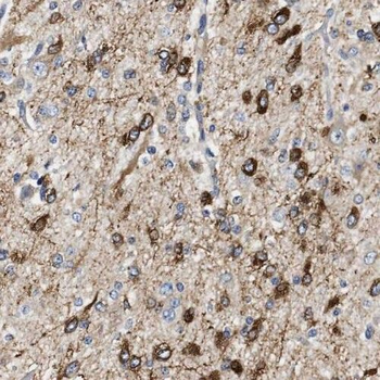PGM2L1 Rabbit Polyclonal Antibody