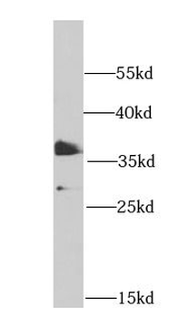 PHF11 Antibody