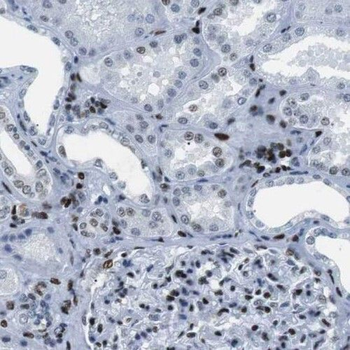 PHF14 Rabbit Polyclonal Antibody