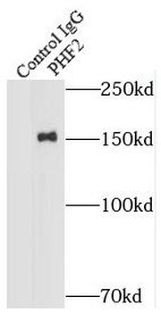 PHF2 Rabbit Polyclonal Antibody