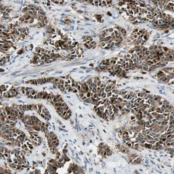 PHF2 Rabbit Polyclonal Antibody