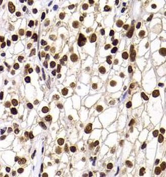 PHIP Rabbit Polyclonal Antibody