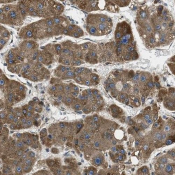 PHKA2 Rabbit Polyclonal Antibody