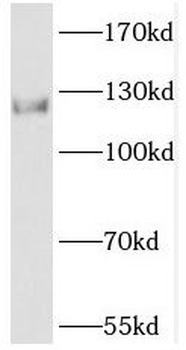 PHKB Antibody