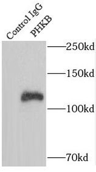 PHKB Rabbit Polyclonal Antibody
