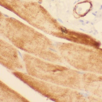 PHKB Rabbit Polyclonal Antibody