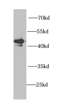 PHKG2 Antibody