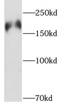 PHLPP1 Antibody