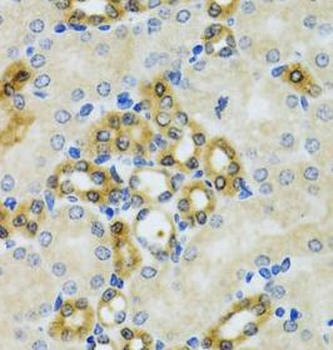 PHPT1 Rabbit Polyclonal Antibody