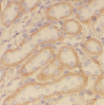 PHYH Rabbit Polyclonal Antibody