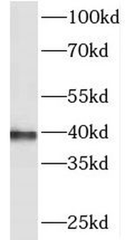 PHYHIPL Antibody