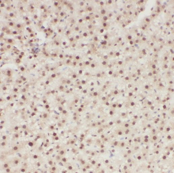 PI4K2B Rabbit Polyclonal Antibody