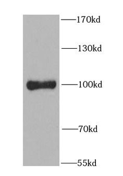 PIBF1 Antibody