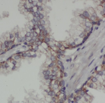 PIGB Rabbit Polyclonal Antibody