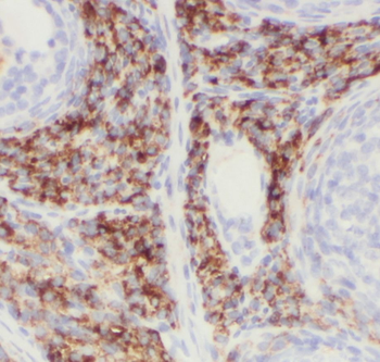 PIGK Rabbit Polyclonal Antibody