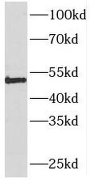 PIGM Antibody