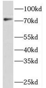 PIGO Antibody