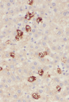 PIGO Rabbit Polyclonal Antibody