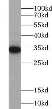 PIH1D1 Antibody
