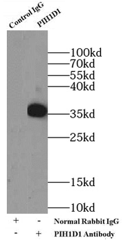 PIH1D1 Rabbit Polyclonal Antibody