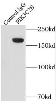 PIK3C2B Rabbit Polyclonal Antibody