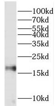 PIN1 Rabbit Polyclonal Antibody