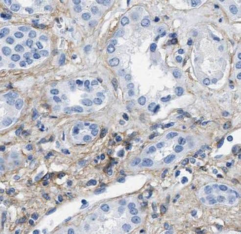 PIN1 Rabbit Polyclonal Antibody
