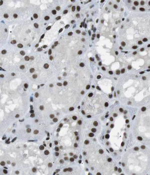 PNN Rabbit Polyclonal Antibody
