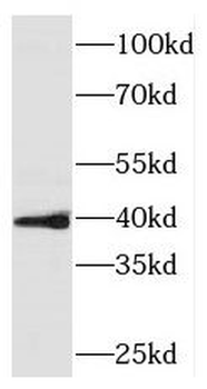 PINX1 Antibody