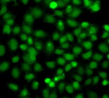 PIP5K1A Rabbit Polyclonal Antibody