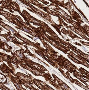 PIP5K1A Rabbit Polyclonal Antibody