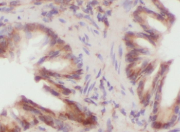 PIP5K1B Rabbit Polyclonal Antibody