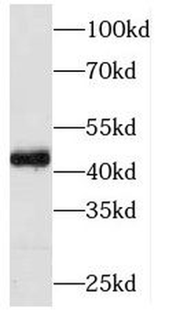 PIP5KL1 Antibody