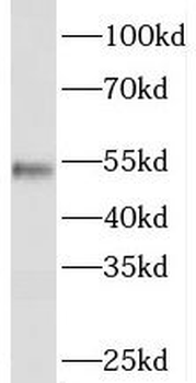 PISD Antibody