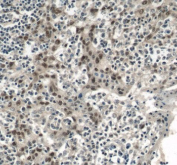 PITX1 Rabbit Polyclonal Antibody