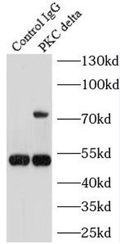 PRKCD Rabbit Polyclonal Antibody