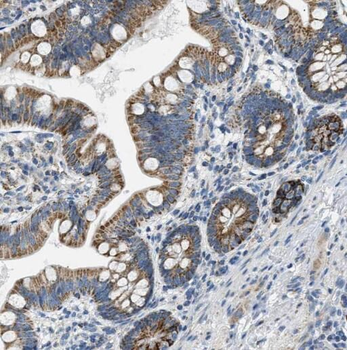 PRKCD Rabbit Polyclonal Antibody