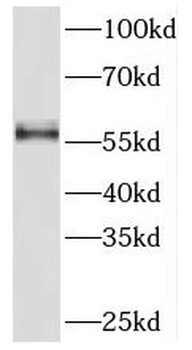PKM Rabbit Polyclonal Antibody