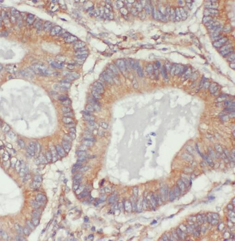 PKM Rabbit Polyclonal Antibody