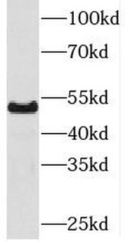PKNOX1 Antibody