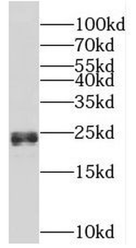 CSH1 Rabbit Polyclonal Antibody