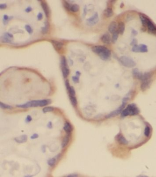 ALPP Rabbit Polyclonal Antibody
