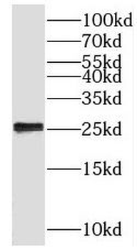 BLOC1S6 Antibody