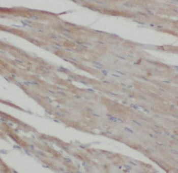 PLEK2 Rabbit Polyclonal Antibody