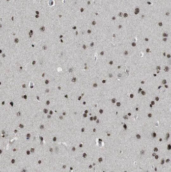 PLEKHF1 Rabbit Polyclonal Antibody