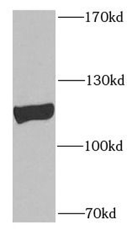 PLK4 Antibody