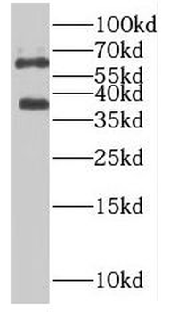 PLS3 Antibody