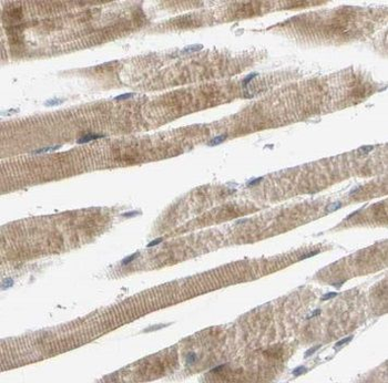 PLS3 Rabbit Polyclonal Antibody