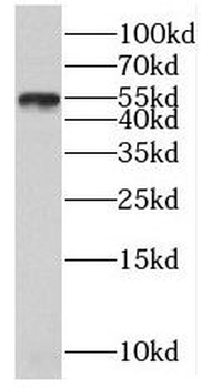PLXDC2 Antibody
